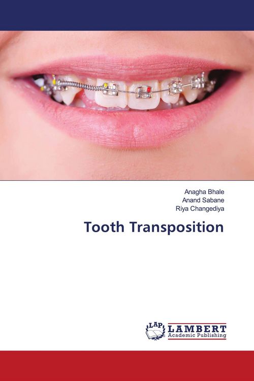 Produktbild: Tooth Transposition