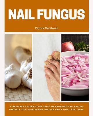 Produktbild: Nail Fungus
