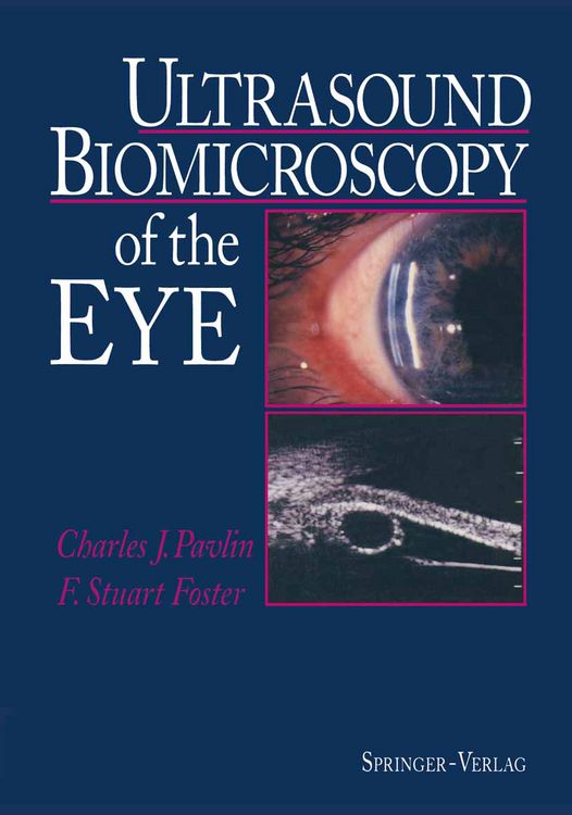 Produktbild: Ultrasound Biomicroscopy of the Eye
