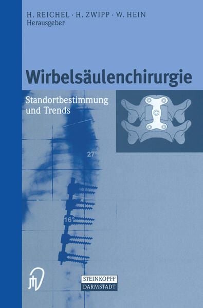 Produktbild: Wirbels&auml;ulenchirurgie