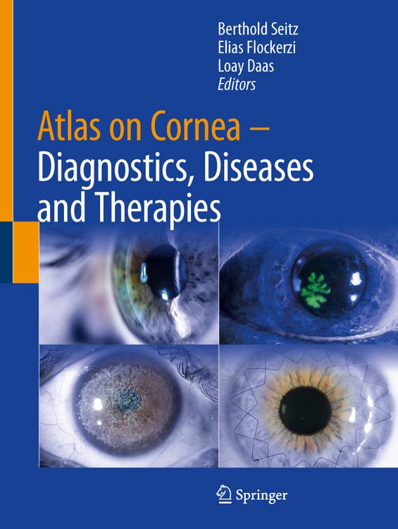 Produktbild: Atlas on Cornea
