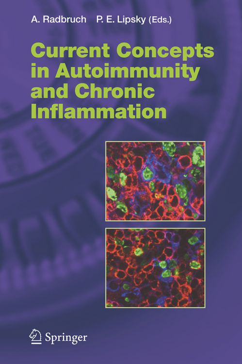 Produktbild: Current Concepts in Autoimmunity and Chronic Inflammation