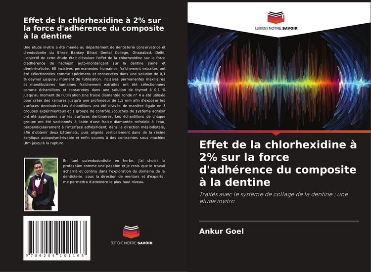 Produktbild: Effet de la chlorhexidine &agrave; 2% sur la force d'adh&eacute;rence du composite &agrave; la dentine