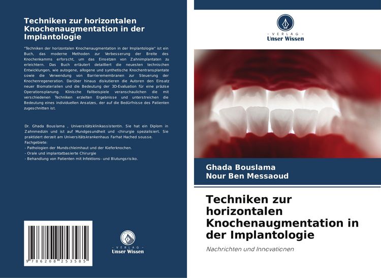Produktbild: Techniken zur horizontalen Knochenaugmentation in der Implantologie