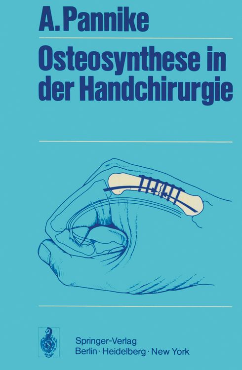 Produktbild: Osteosynthese in der Handchirurgie