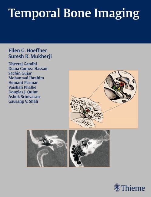 Produktbild: Temporal Bone Imaging