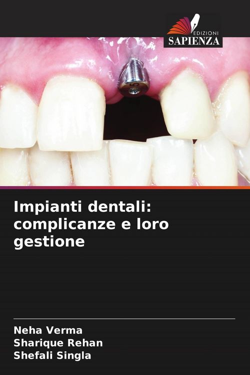 Produktbild: Impianti dentali: complicanze e loro gestione