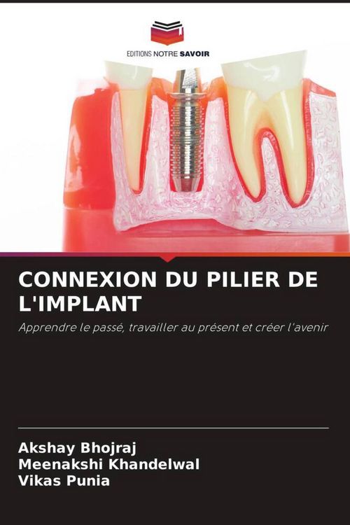 Produktbild: Connexion Du Pilier De L'implant