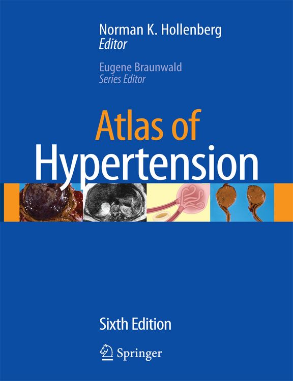 Produktbild: Atlas of Hypertension