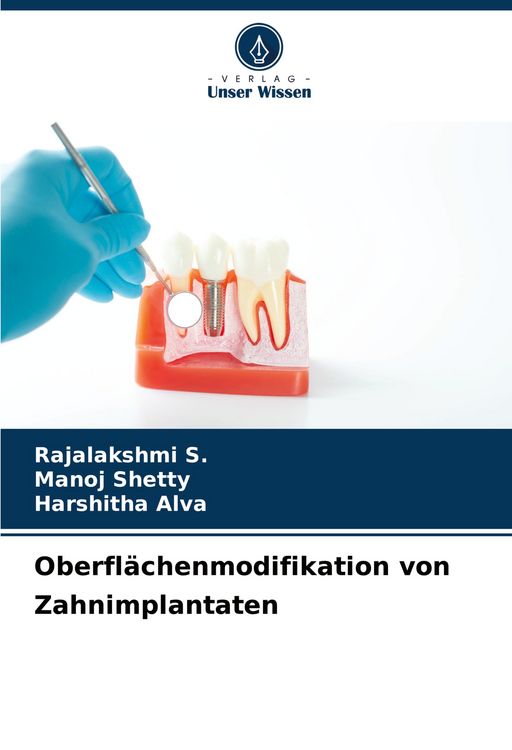 Produktbild: Oberfl&auml;chenmodifikation von Zahnimplantaten