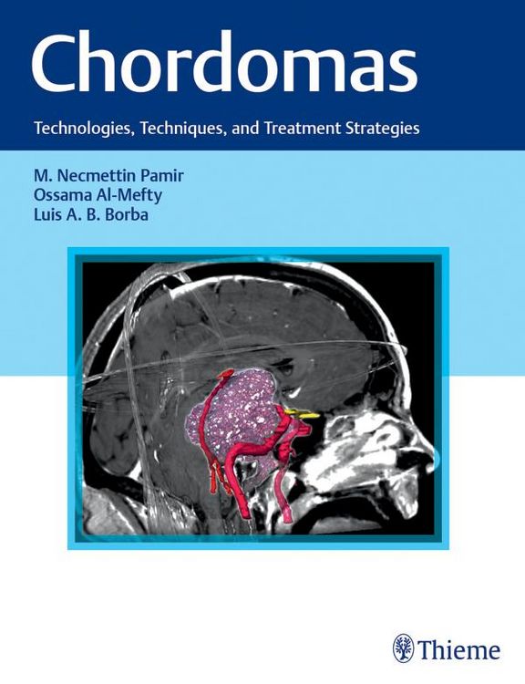 Produktbild: Chordomas