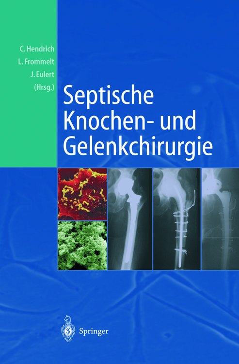 Produktbild: Septische Knochen-und Gelenkchirurgie