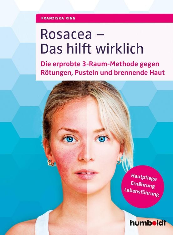 Produktbild: Rosacea - Das hilft wirklich