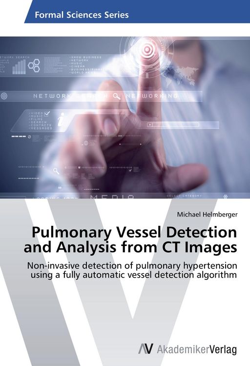 Produktbild: Pulmonary Vessel Detection and Analysis from CT Images