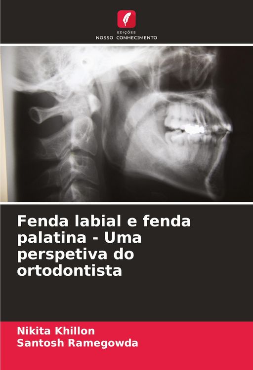 Produktbild: Fenda labial e fenda palatina - Uma perspetiva do ortodontista
