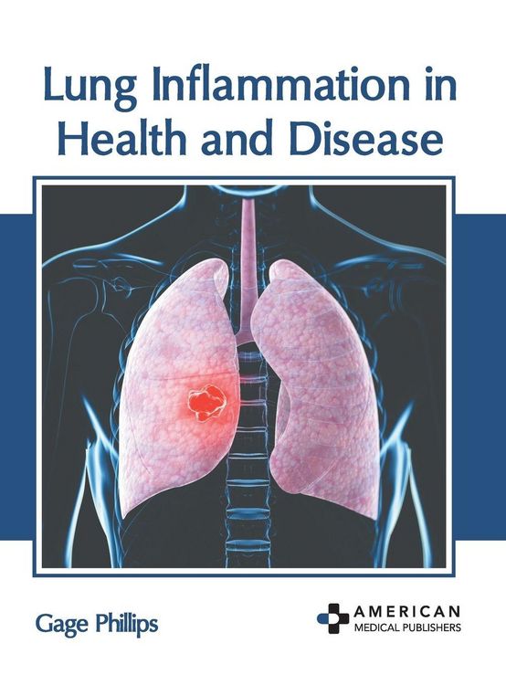 Produktbild: Lung Inflammation in Health and Disease