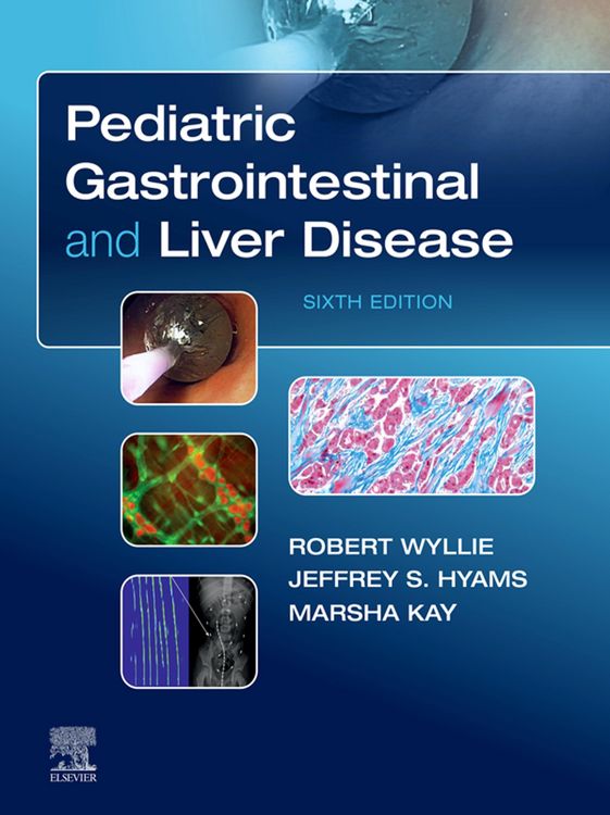 Produktbild: Pediatric Gastrointestinal and Liver Disease E-Book