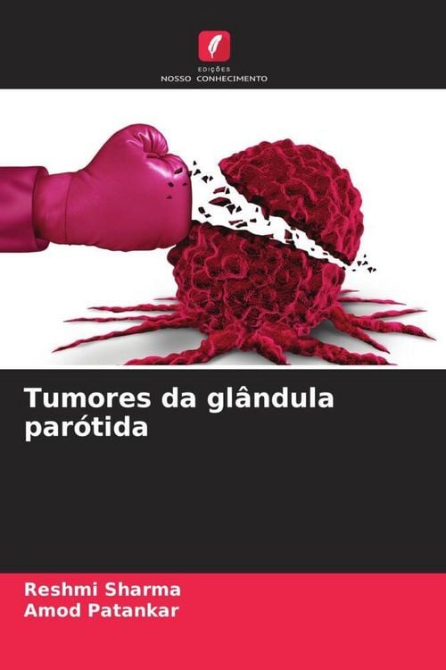 Produktbild: Tumores da gl&acirc;ndula par&oacute;tida