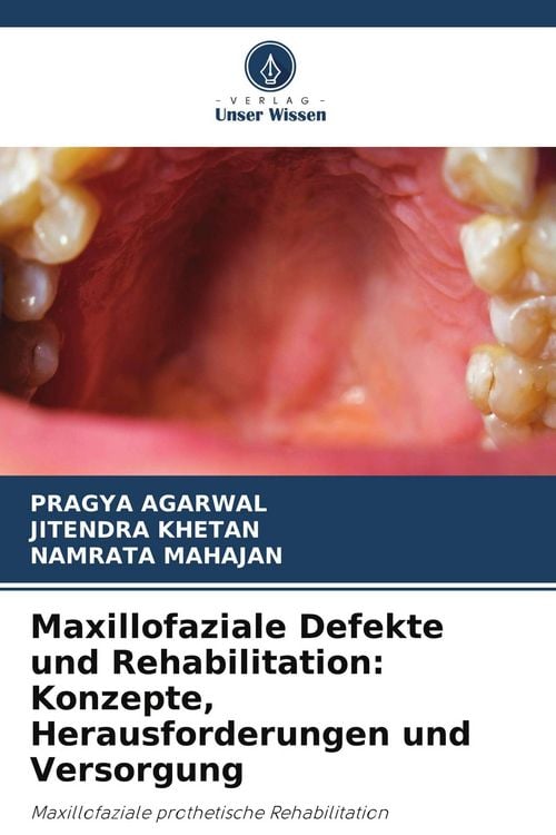 Produktbild: Maxillofaziale Defekte und Rehabilitation: Konzepte, Herausforderungen und Versorgung
