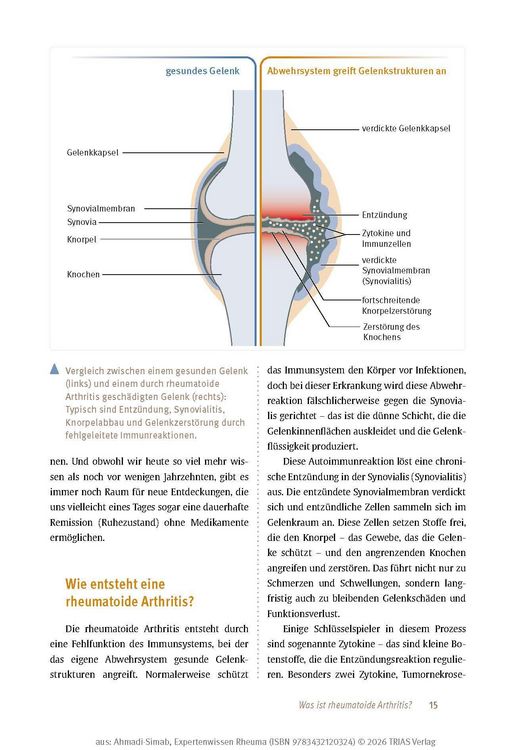 Produktbild: Expertenwissen: Rheuma
