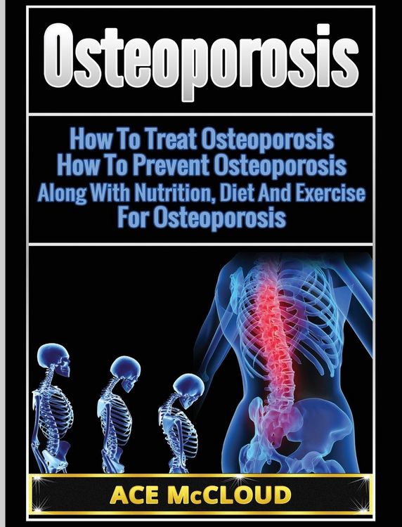 Produktbild: Osteoporosis
