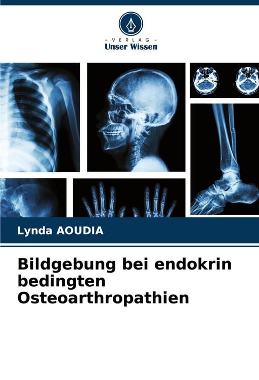 Produktbild: Bildgebung bei endokrin bedingten Osteoarthropathien