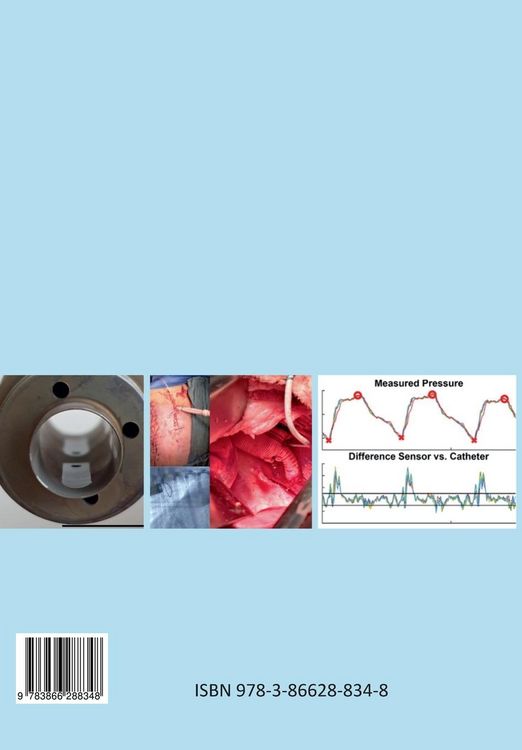 Produktbild: Implantable Pressure Sensor Encapsulation for Ventricular Assist Device Control