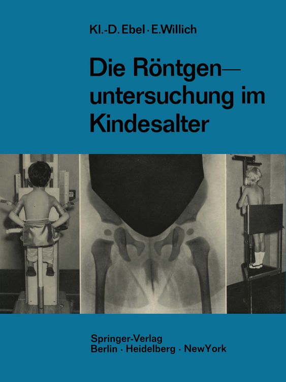 Produktbild: Die R&ouml;ntgenuntersuchung im Kindesalter