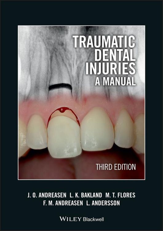 Produktbild: Traumatic Dental Injuries