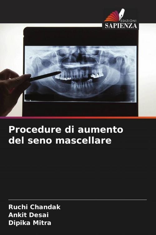Produktbild: Procedure di aumento del seno mascellare