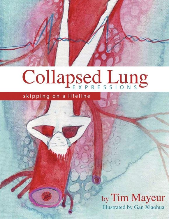 Produktbild: Collapsed Lung Expressions