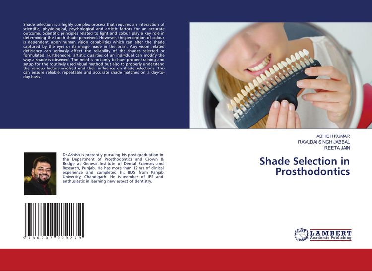 Produktbild: Shade Selection in Prosthodontics