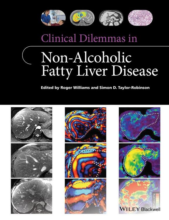Produktbild: Clinical Dilemmas in Non-Alcoholic Fatty Liver Disease