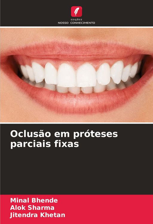 Produktbild: Oclus&atilde;o em pr&oacute;teses parciais fixas