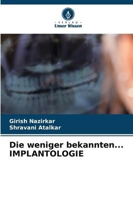 Produktbild: Die weniger bekannten... IMPLANTOLOGIE