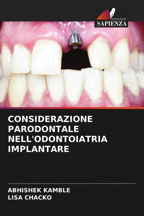 Produktbild: Considerazione Parodontale Nell'odontoiatria Implantare