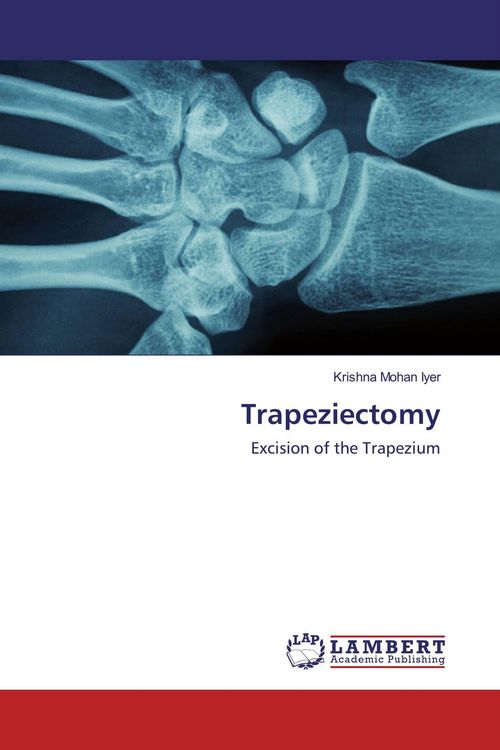 Produktbild: Trapeziectomy
