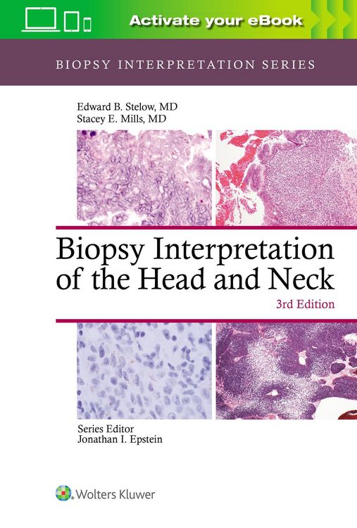 Produktbild: Biopsy Interpretation of the Head and Neck
