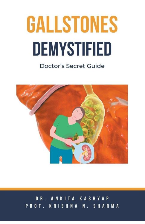 Produktbild: Gallstones Demystified
