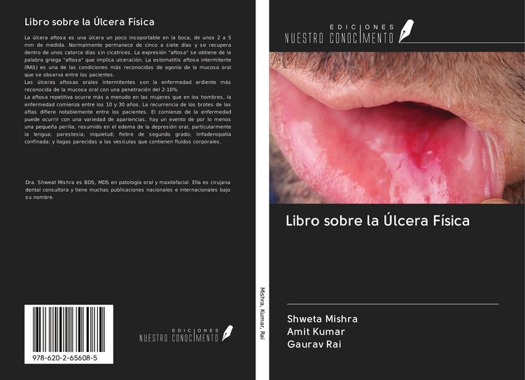 Produktbild: Libro sobre la &Uacute;lcera F&iacute;sica