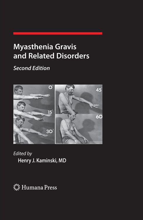 Produktbild: Myasthenia Gravis and Related Disorders