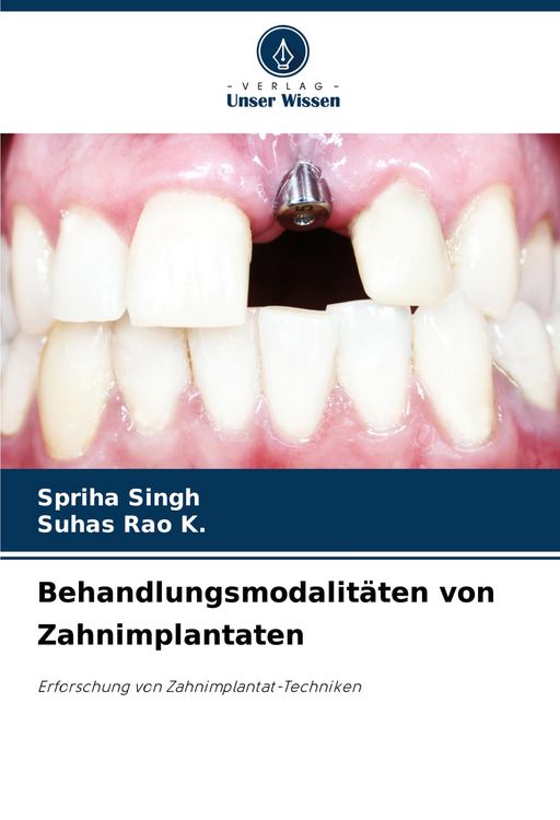 Produktbild: Behandlungsmodalit&auml;ten von Zahnimplantaten