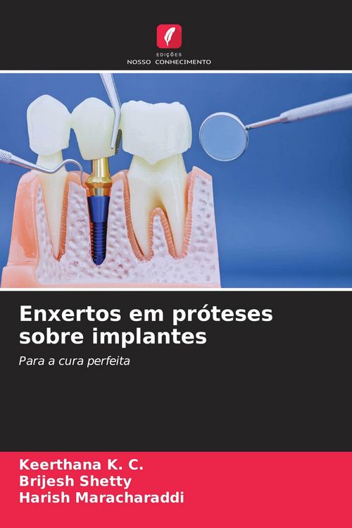 Produktbild: Enxertos em pr&oacute;teses sobre implantes