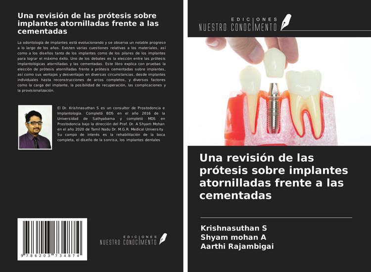 Produktbild: Una revisi&oacute;n de las pr&oacute;tesis sobre implantes atornilladas frente a las cementadas