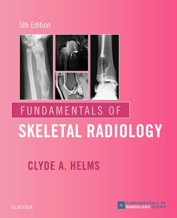 Produktbild: Fundamentals of Skeletal Radiology E-Book