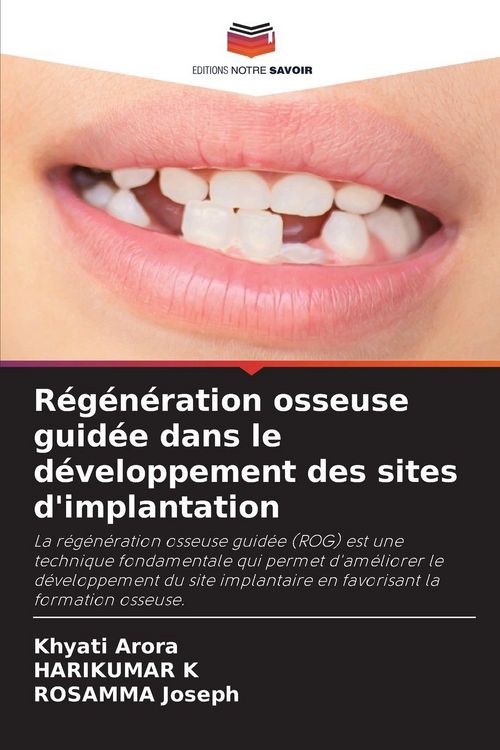 Produktbild: R&eacute;g&eacute;n&eacute;ration osseuse guid&eacute;e dans le d&eacute;veloppement des sites d'implantation