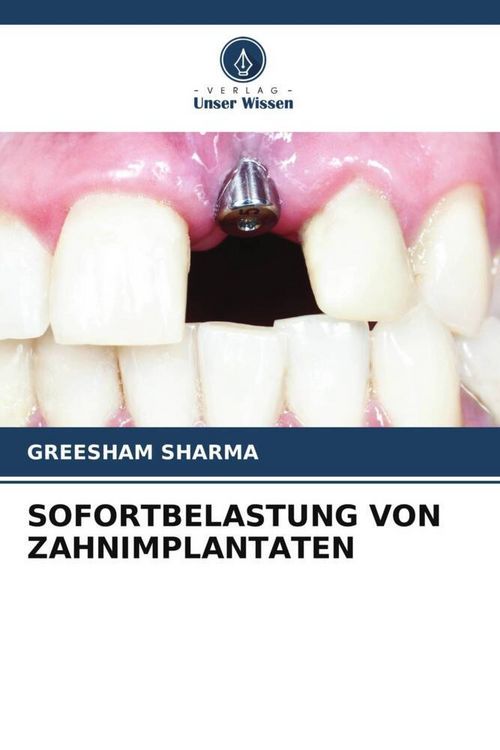 Produktbild: Sofortbelastung von Zahnimplantaten