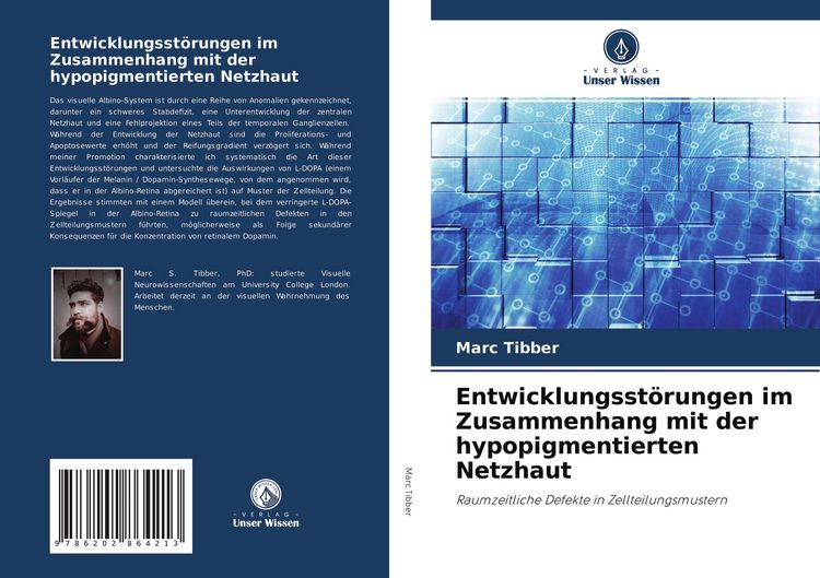 Produktbild: Entwicklungsst&ouml;rungen im Zusammenhang mit der hypopigmentierten Netzhaut