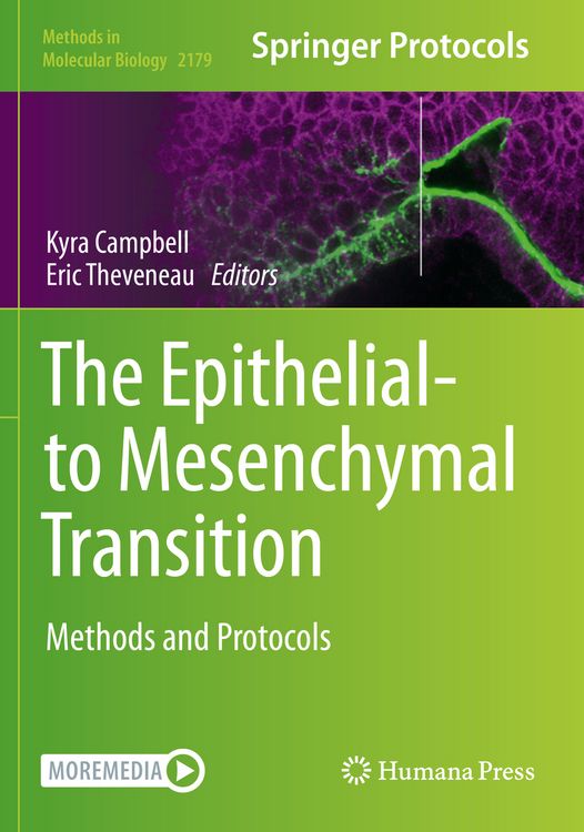 Produktbild: The Epithelial-to Mesenchymal Transition