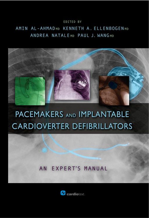 Produktbild: Pacemakers and Implantable Cardioverter Defibrillators: An Expert's Manual
